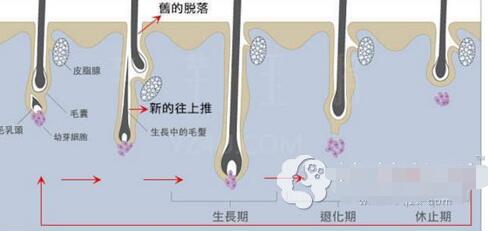 做了激光脱唇毛会复发吗