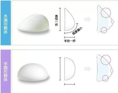 武汉艺星和五洲隆胸哪个好