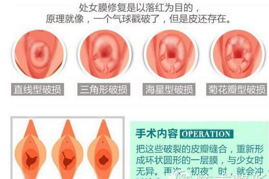 中山爱思特*全私密整形价格表